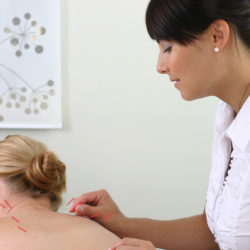 Fertility acupuncture | Benefits of acupuncture | RSC Bay Area