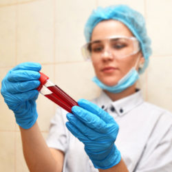 365 days in a fertility clinic | NIAW | RSC SF Bay Area | Woman examining vials of blood